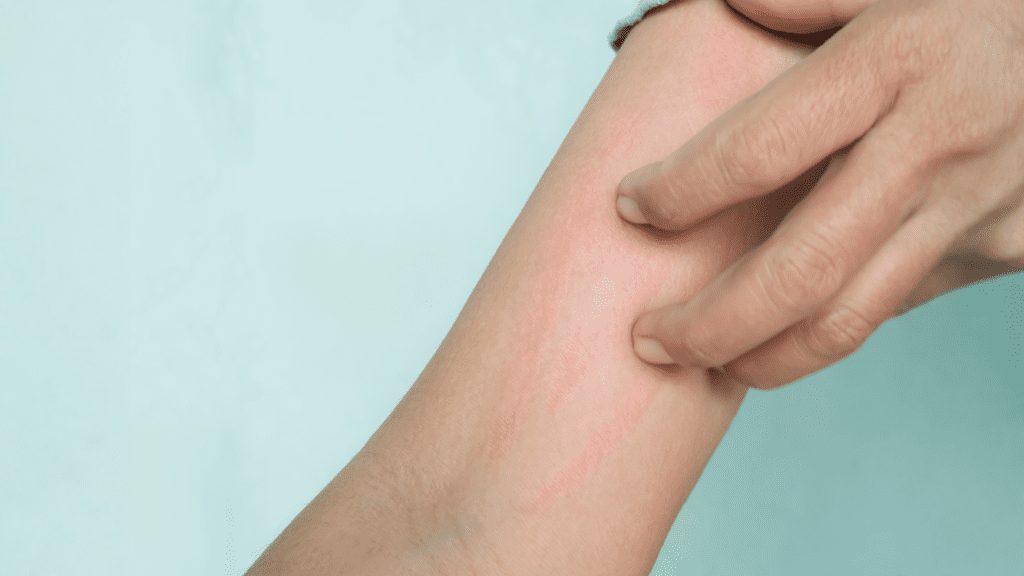 Bahaya limbah cair dari toilet dan kakus (black water)